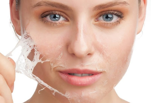 Peel da là gì? Peel da có tác dụng gì?